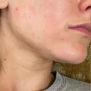 Before image