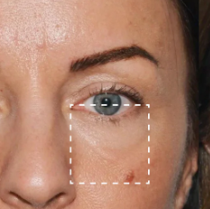 Before image